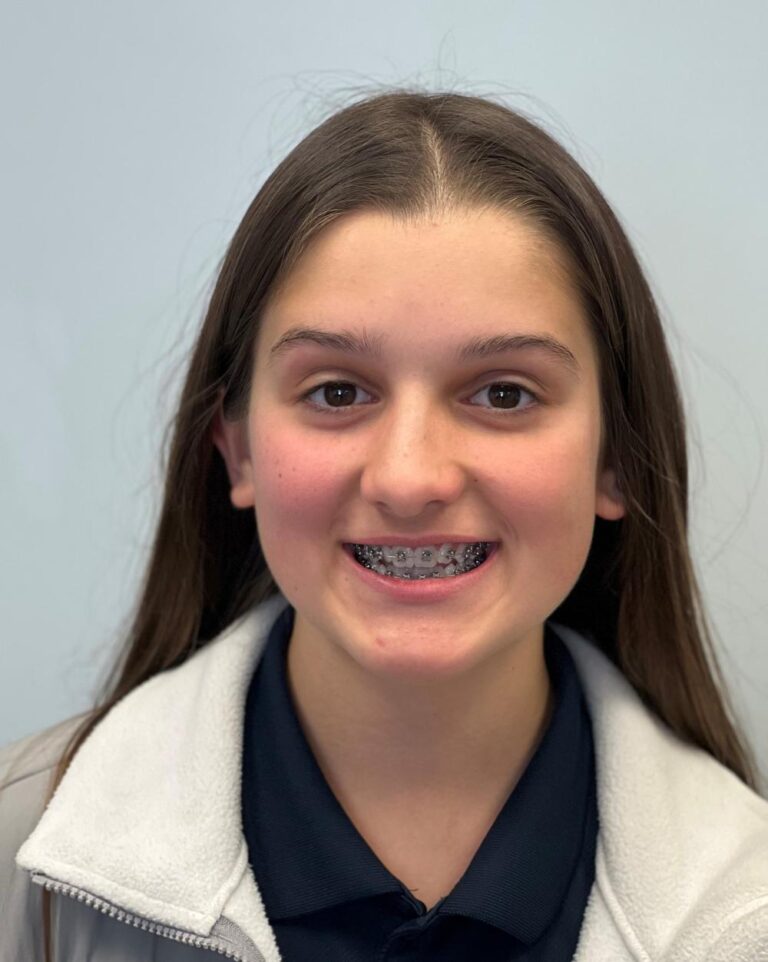 Orthodontists in Lafayette & City, LA Braces & Invisalign